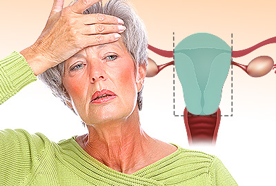 ¿Por qué ocurren sofocos después de una histerectomía?