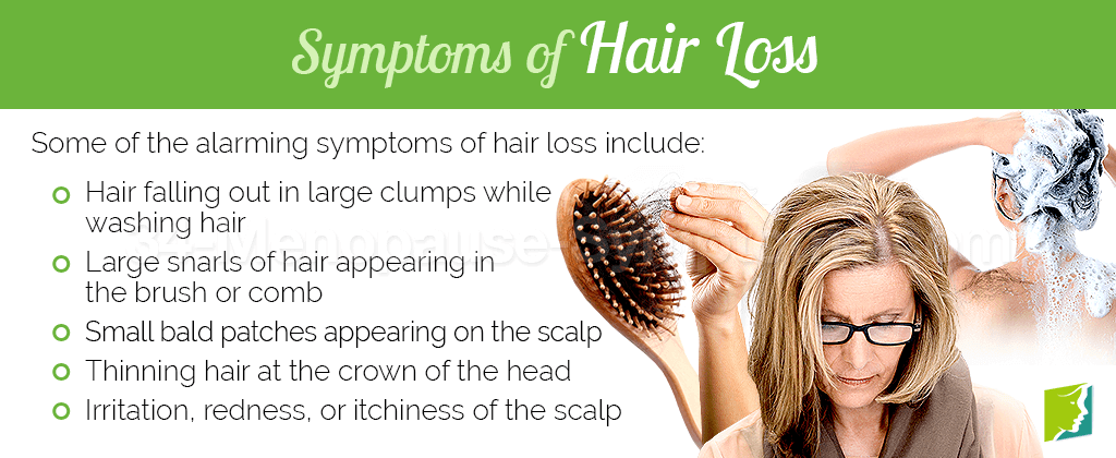 Symptoms of hair loss