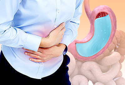 Sour Stomach: Important Things to Know