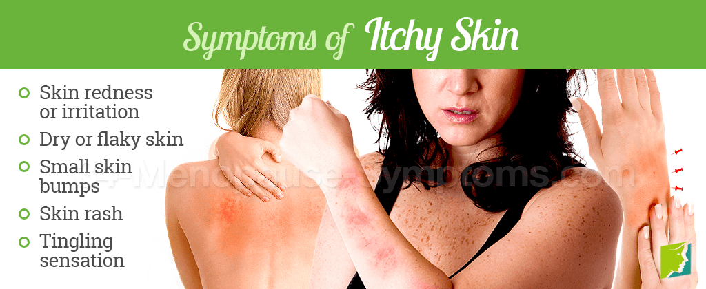 Symptoms of Itchy Skin