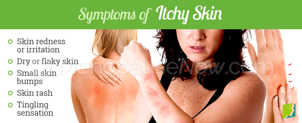 Symptoms of Itchy Skin