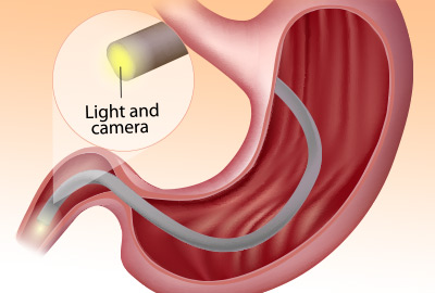 Signs of Digestive Problems : Stomach and Intestinal
