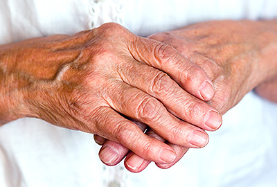 Osteoporosis in Older Women