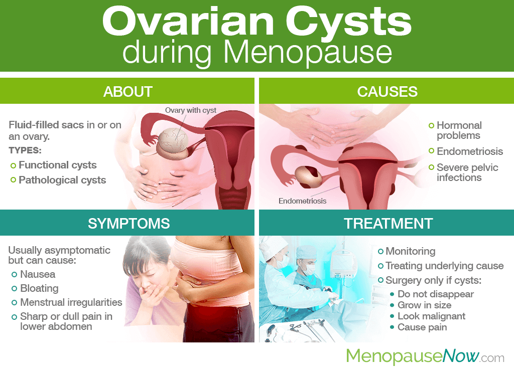 Ovarian Cyst Symptoms And Signs