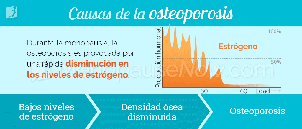 Causas de la osteoporosis