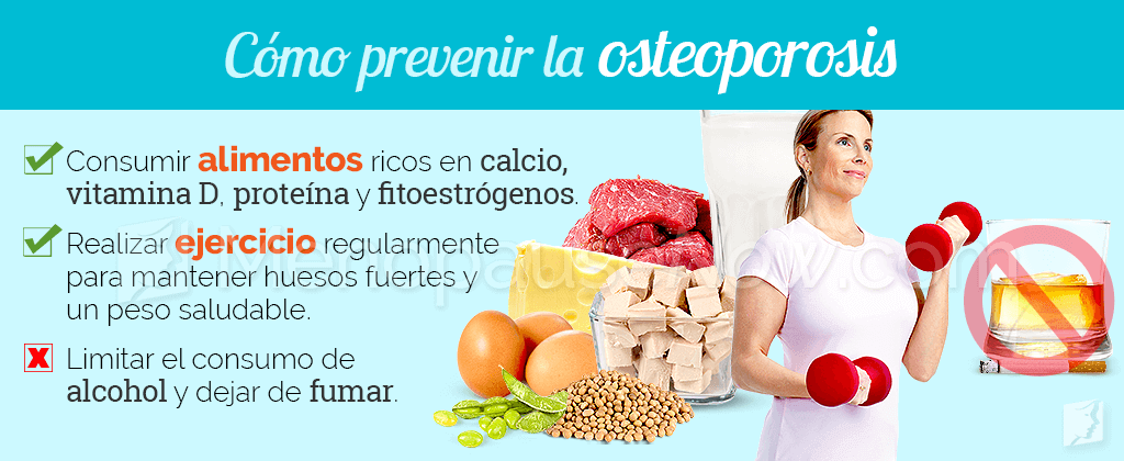 Prevención de la osteoporosis