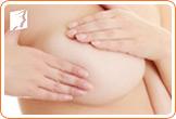 Q&A: Breast Tenderness