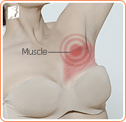 Treating Breast Tenderness 1