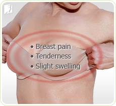 Breast Pain Types