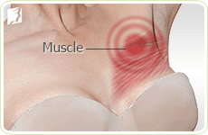Breast Pain Women