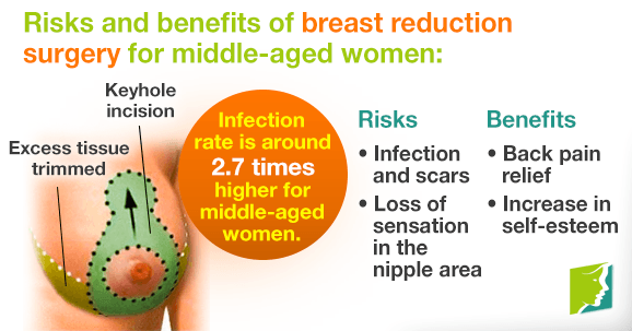 Benefits of Breast Reduction Surgery