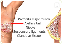 Breast Tenderness