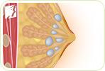 Breasts Cysts: Should I Be Worried?