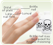 brittle nails arsenic poison