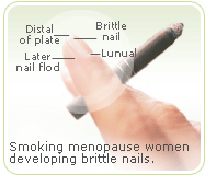 Brittle nail news