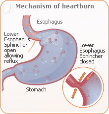 burning-tongue-esophagus