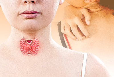 Picazón en el cuerpo y problemas de tiroides