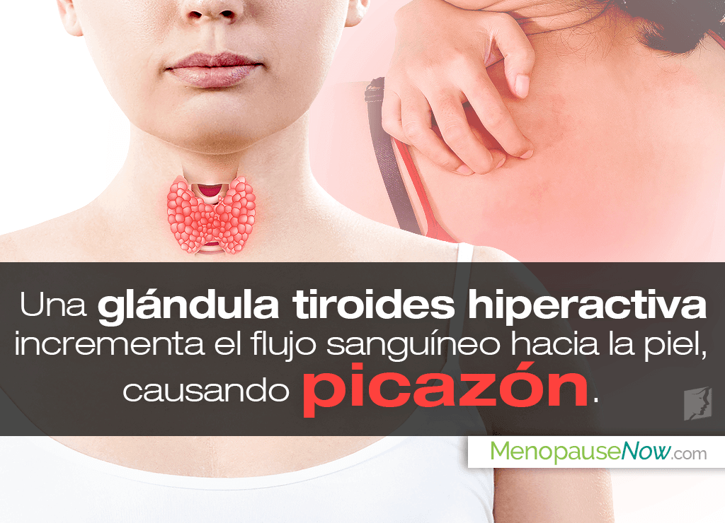 Picazón en el cuerpo y problemas de tiroides