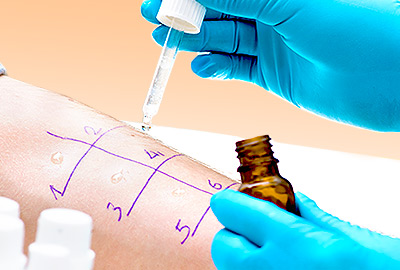 Allergy Testing: 3 Different Tests