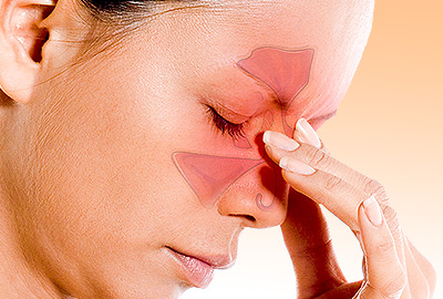 Sinus Migraines: All You Need to Know