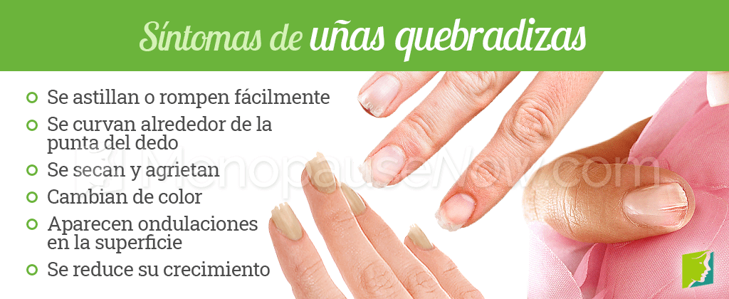 Síntomas de uñas quebradizas