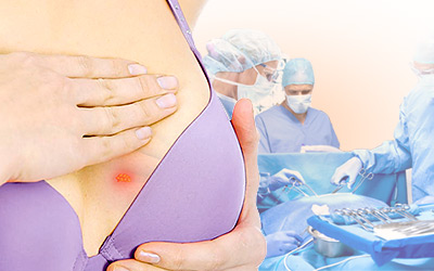 8 razones para la sensibilidad y dolor en los senos