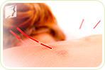 Can Acupuncture Relieve Joint Pain?