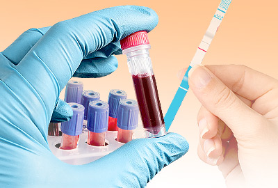 Testing for Perimenopause