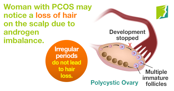 Irregular periods do not lead to hair loss