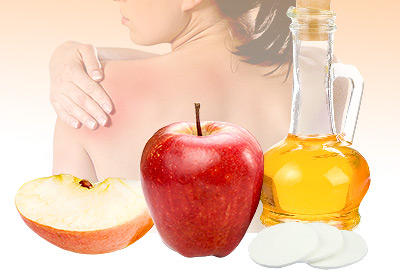 Choosing a Natural Remedy for Itchy Skin