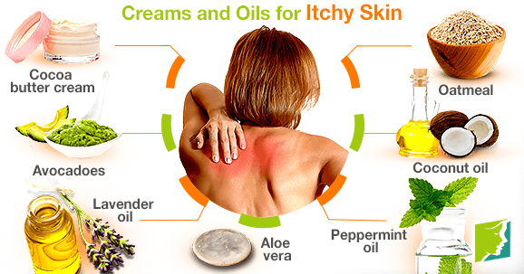 Creams and Oils for Itchy Skin