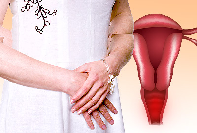 Causas de sangrado después de la menopausia