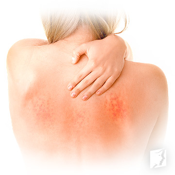 itchiness