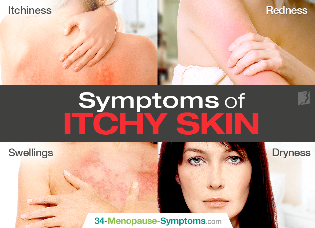 symptoms of itchy skin