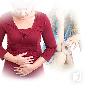 irritable bowel syndrome