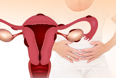 Período irregular y flujo marrón