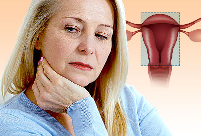 Depression After Hysterectomy