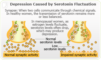 Causes of Depression 1