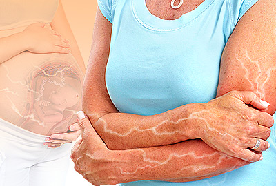 Differences between Electric Shocks in Pregnancy and Menopause