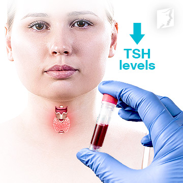 abnormal thyroid panel