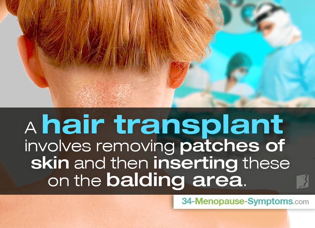 A hair transplant involves removing patches of skin and then inserting these on the balding area.