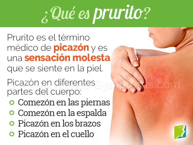 ¿Qué es prurirto?