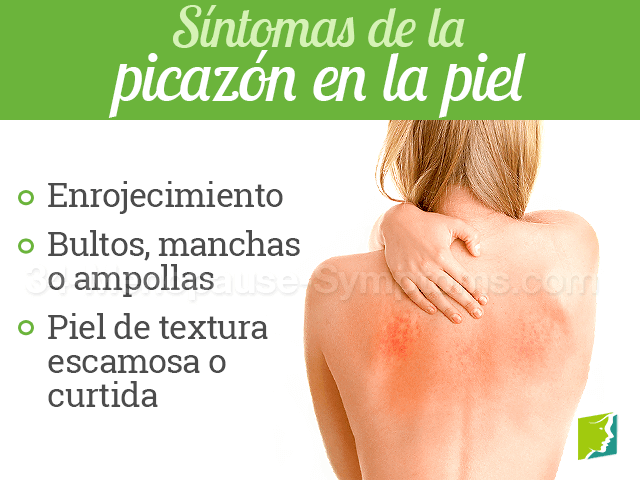 Síntomas de la picazón en la piel