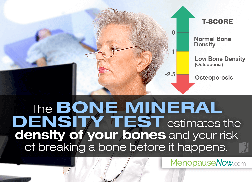 Bone Density Results: T & Score | Now