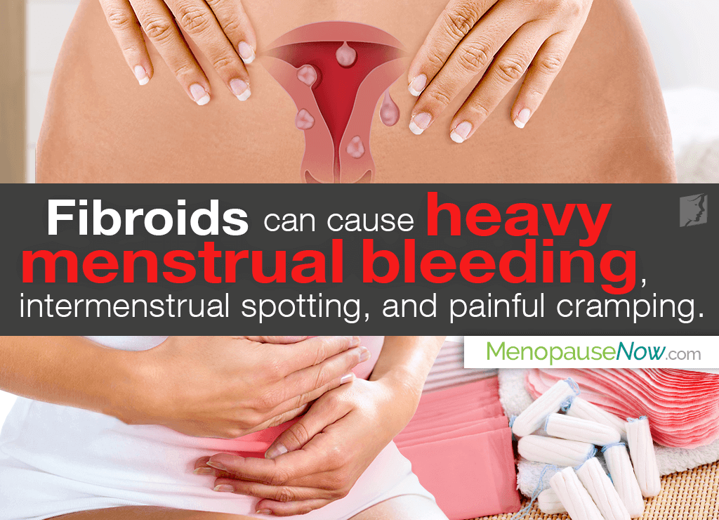 Fibroids can cause heavy menstrual bleeding, unpredictable bleeding between periods, and painful cramping.
