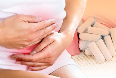 FAQs: Can Uterine Fibroids Cause Irregular Periods?