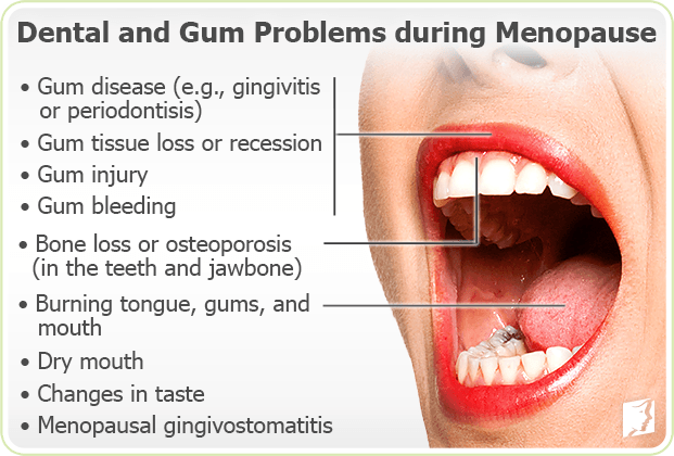 Dental and Gum problems during menopause