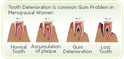 gum problems osteoporosis
