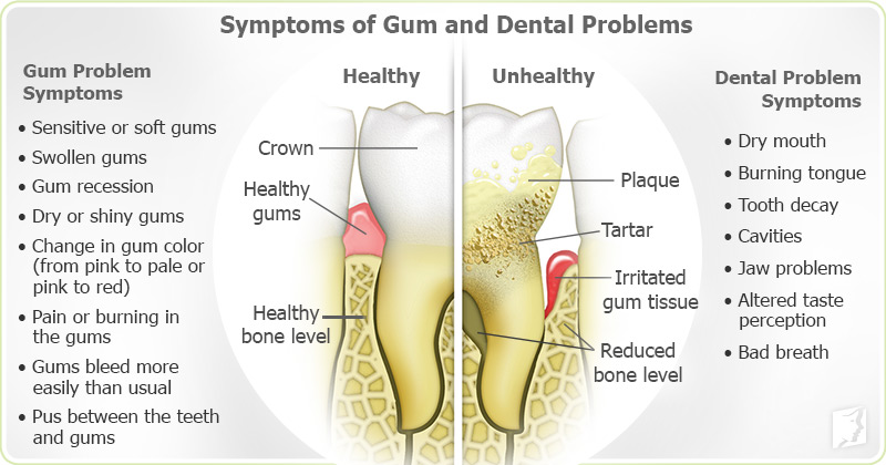 Symptoms of Gum and Dental Problems