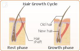 Female Hair Loss before Menopause1